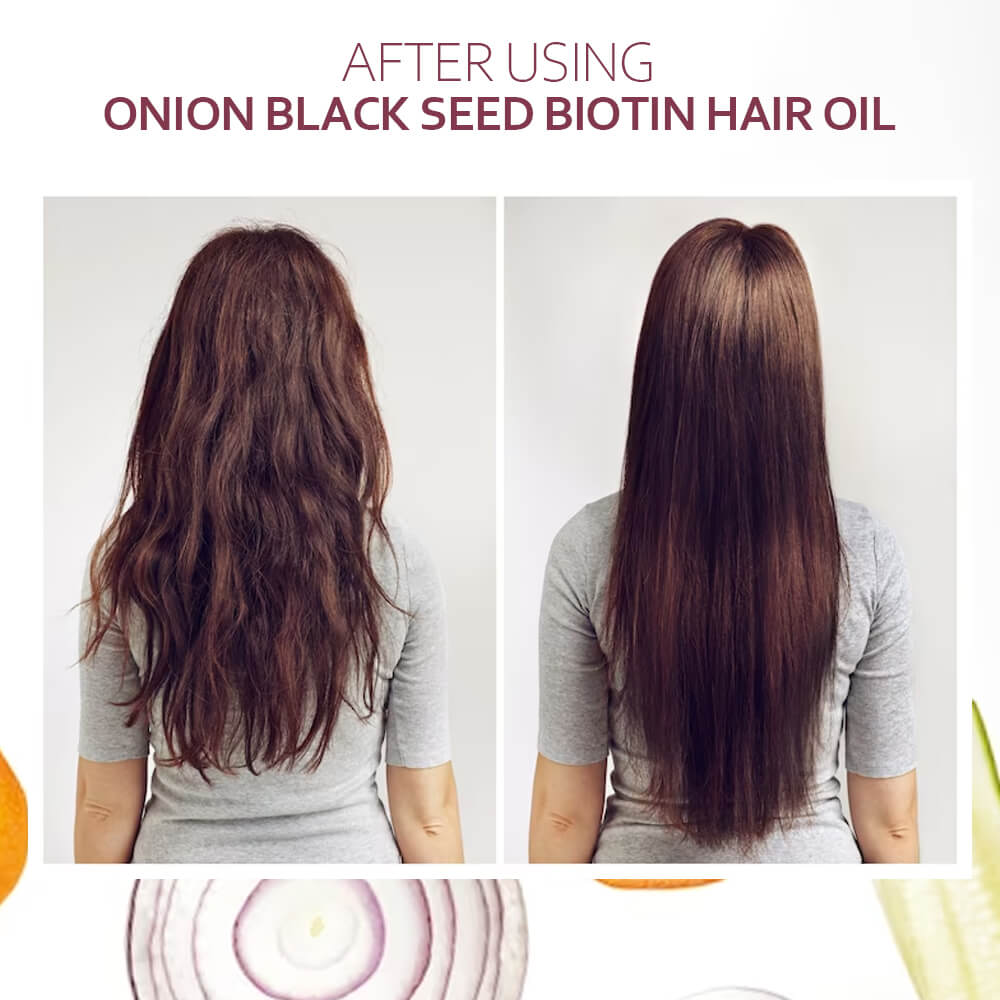 Onion Black Seed Biotin Hair Oil